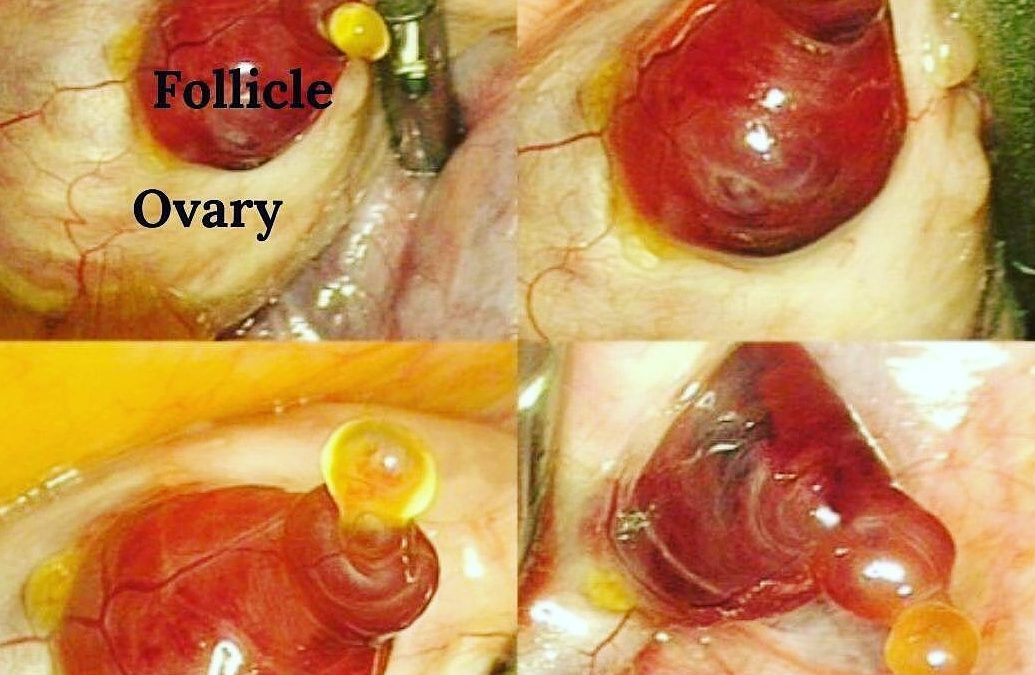 What your Ovaries, Follicles and Eggs Look Like & Why Visualizing Helps Boost Fertility Naturally