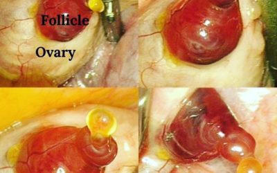 What your Ovaries, Follicles and Eggs Look Like & Why Visualizing Helps Boost Fertility Naturally