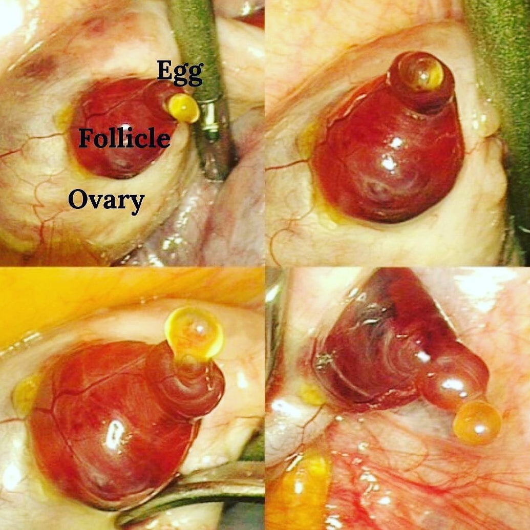 What your Ovaries, Follicles and Eggs Look Like &#038; Why Visualizing Helps Boost Fertility Naturally